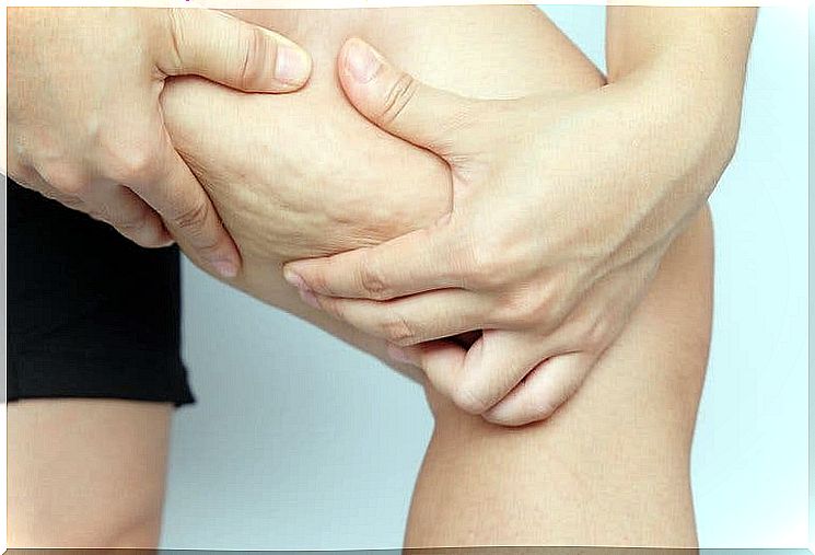 How to reduce cellulite and firm the skin