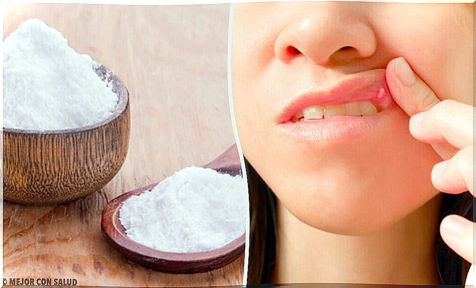 Baking soda helps heal canker sores