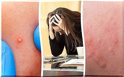 Rashes indicate stress is affecting us too much