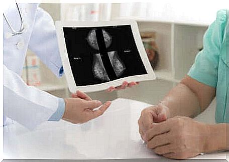 A mammogram in a woman.