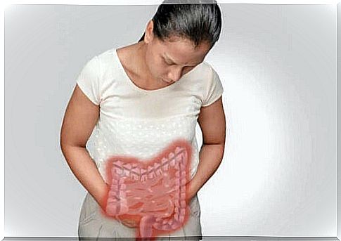 A woman with colorectal cancer.