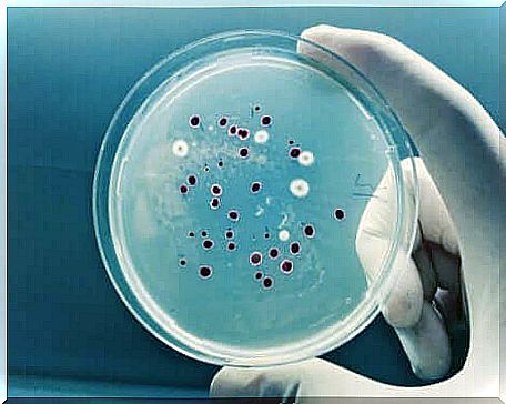 The study of the stool culture on a Petri dish.